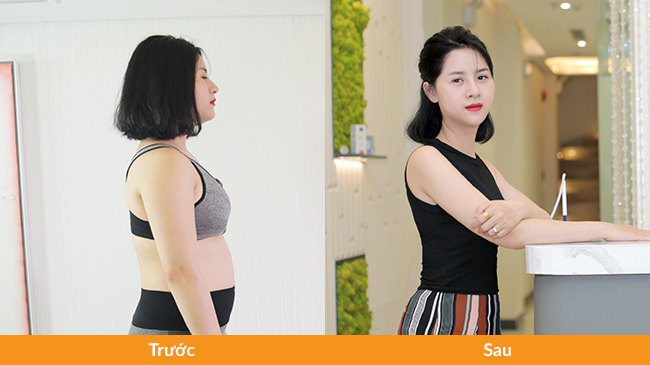 Kết quả pháp giảm béo tại Saigon'smile Spa