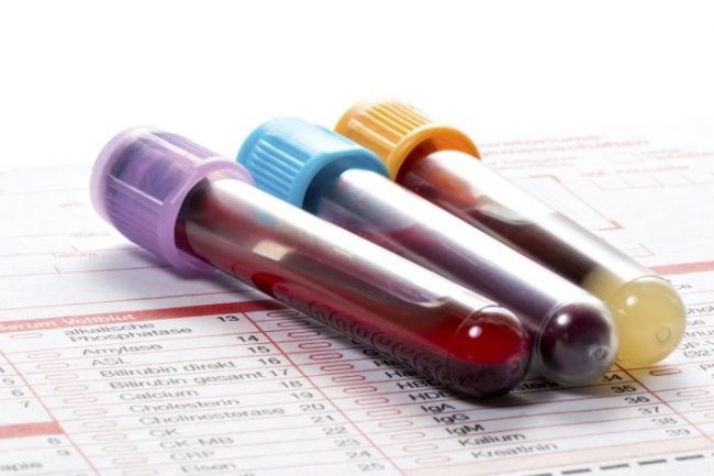 10 chỉ số xét nghiệm máu quan trọng bạn cần biết - 7-Dayslim