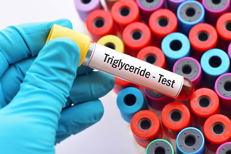 Nên lựa chọn cơ sở uy tín, chất lượng khi thực hiện xét nghiệm Triglyceride