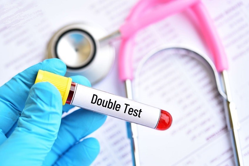 Kết quả Double test nguy cơ cao cần phải làm gì? - Viện công nghệ DNA