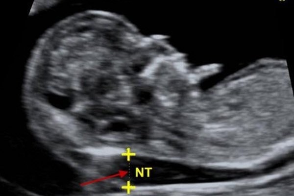 Các xét nghiệm khi mang thai và cột mốc xét nghiệm quan trọng - 7-Dayslim