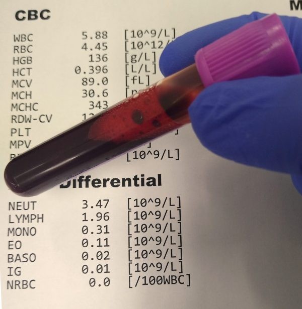 Các xét nghiệm máu khi mang thai mẹ bầu cần biết - 7-Dayslim