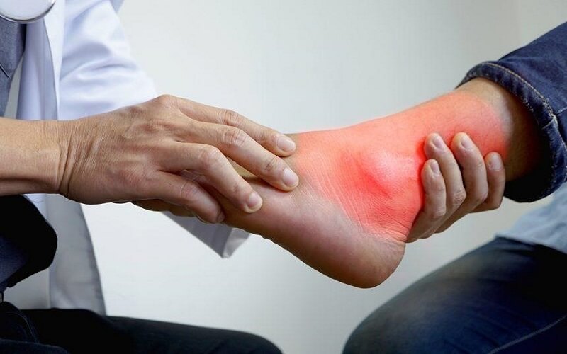 Người bệnh gout thường bị đau đớn dữ dội ở các ngón chân