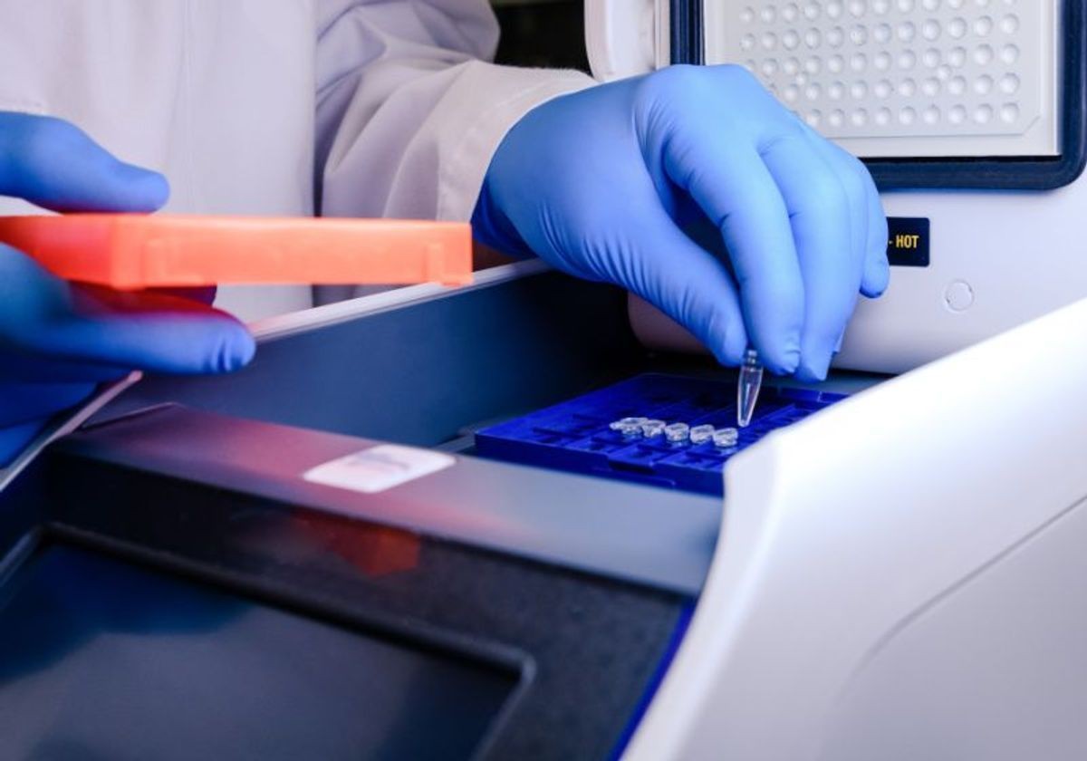 Giá xét nghiệm PCR là bao nhiêu? Nên xét nghiệm PCR ở đâu? - 7-Dayslim