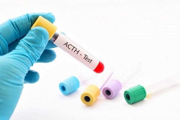 Hormone ACTH: chức năng và ý nghĩa xét nghiệm - 7-Dayslim