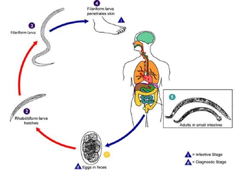 Xét nghiệm chẩn đoán bệnh ấu trùng giun lươn - 7-Dayslim