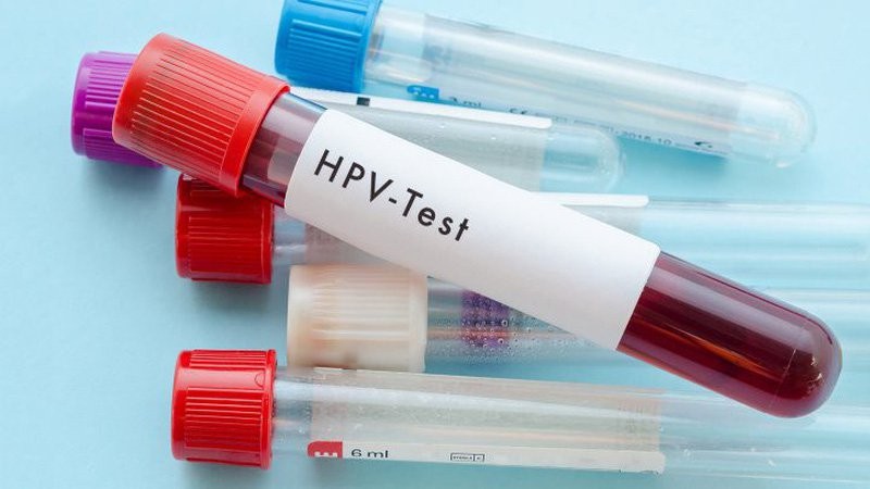 Xét nghiệm HPV là gì? Lưu ý và cách đọc kết quả xét nghiệm - 7-Dayslim