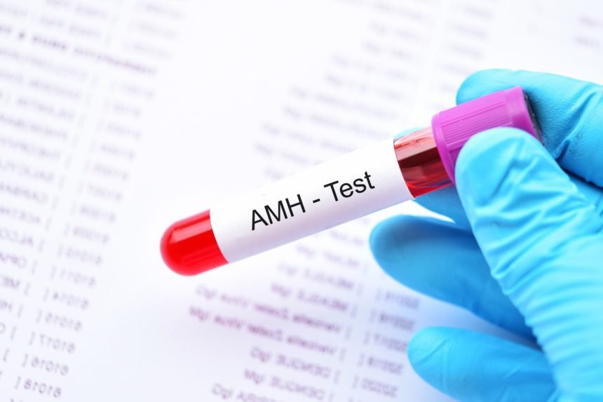 Xét nghiệm AMH là gì và cách đọc kết quả xét nghiệm - 7-Dayslim