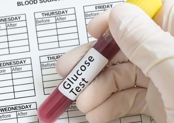 Xét nghiệm glucose là gì? Những phương pháp xét nghiệm phổ biến - 7-Dayslim