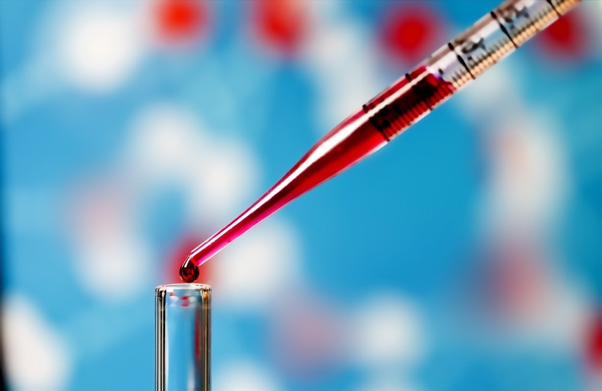 Xét nghiệm máu là gì? Ý nghĩa và cách đọc kết quả xét nghiệm máu