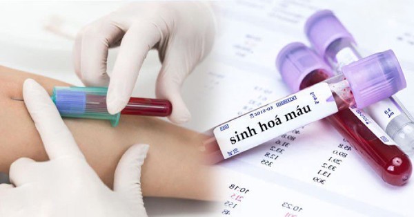 Xét nghiệm máu là gì? Ý nghĩa và cách đọc kết quả xét nghiệm máu