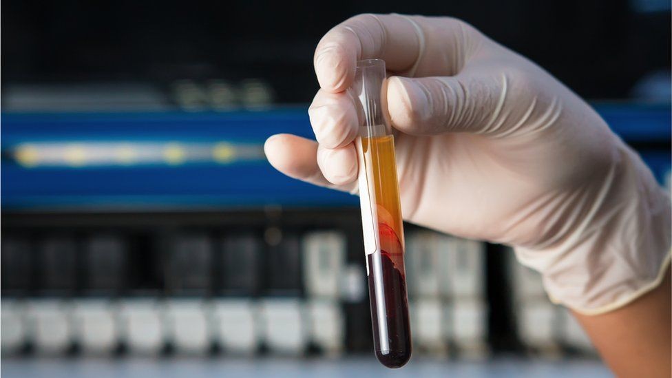 Xét nghiệm máu để làm gì? Các loại xét nghiệm máu - 7-Dayslim