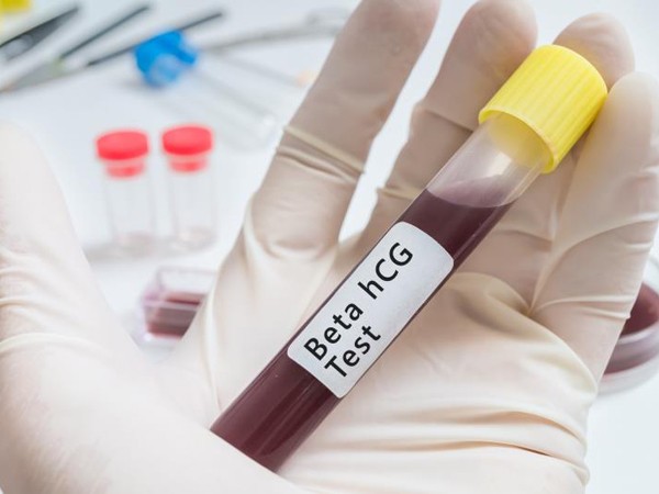 Xét nghiệm máu để làm gì? Các loại xét nghiệm máu - 7-Dayslim
