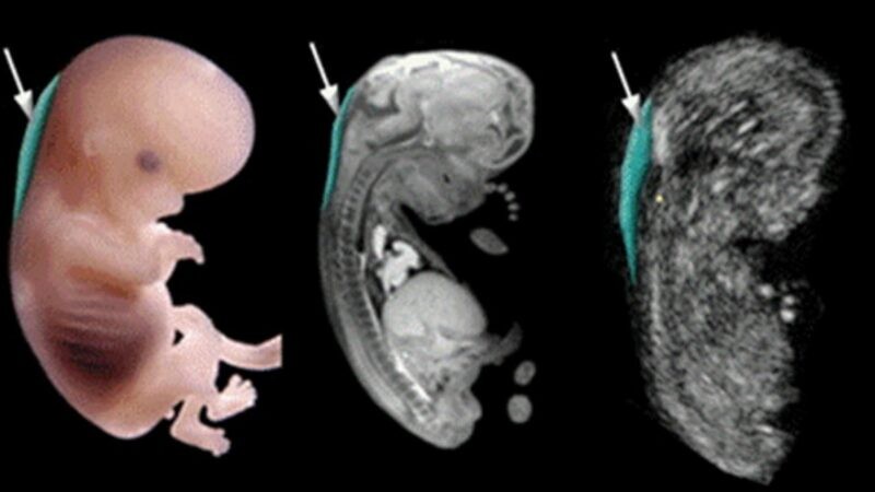 Các xét nghiệm sàng lọc 3 tháng đầu thai kỳ mẹ bầu cần quan tâm - 7-Dayslim